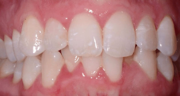 Before treatment 2