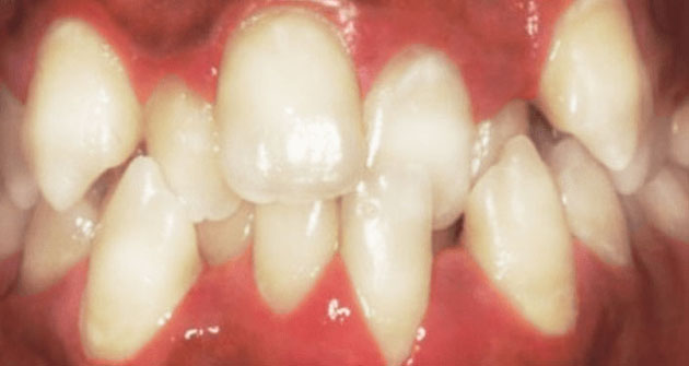 Before treatment 4